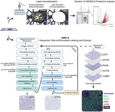 Laser microdissection, proteomics, and multiplex immunohistochemistry: a bumpy ride into the study of paraffin-embedded fetal and pediatric lung tissues